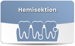 Hemisektion