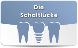 Implantologie Schaltlücke