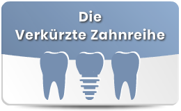 Implantologie Zahnreihe