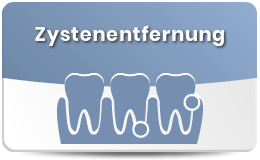 Zystenentfernung