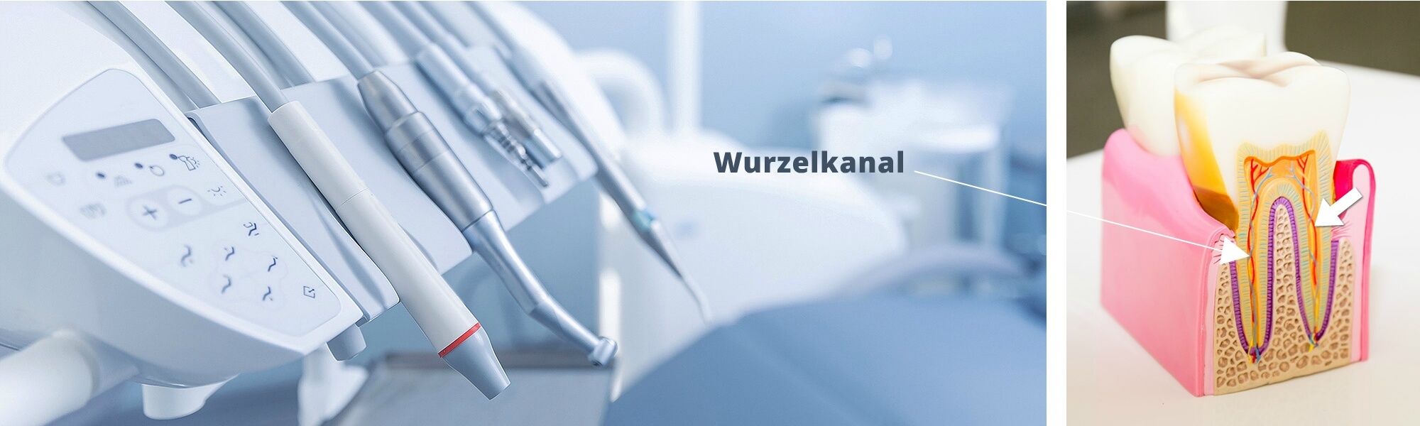 Ansicht eines Zahnarztstuhls mit einem Zahn in Querschnitt, der die Darstellung eines Wurzelkanals zeigt.